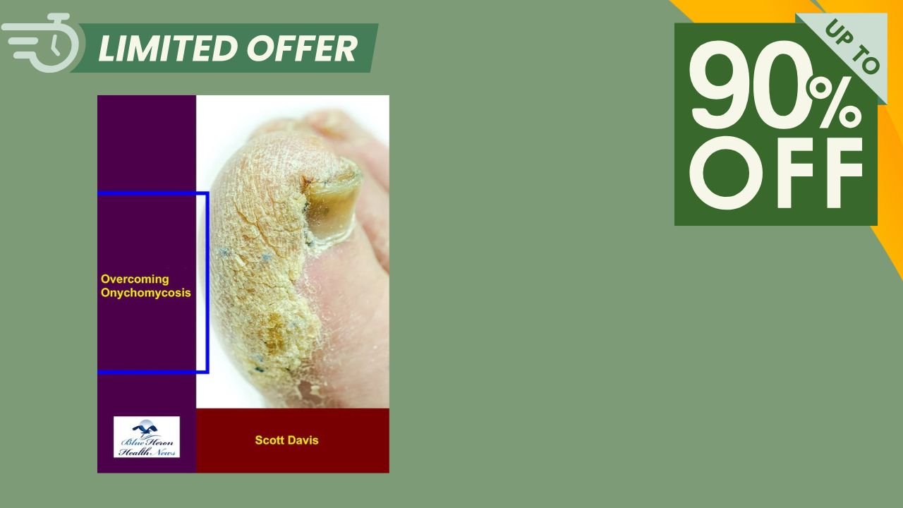 Overcoming Onychomycosis