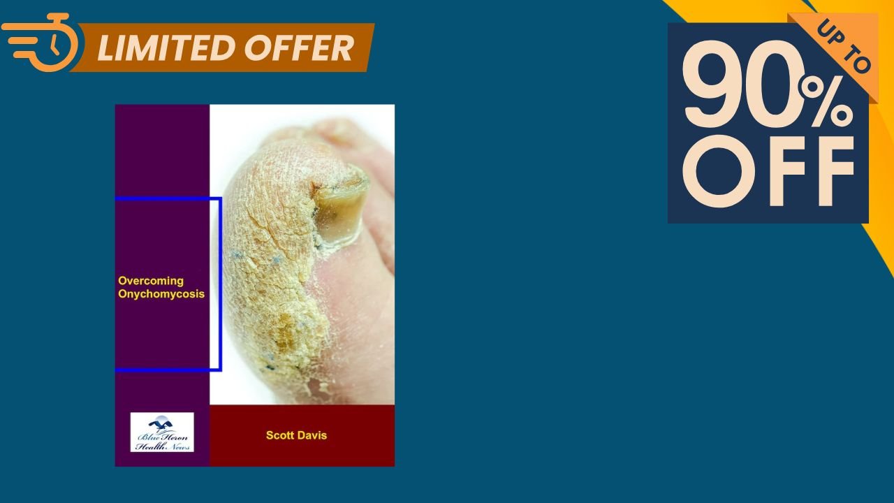 Overcoming Onychomycosis Reviews 2026